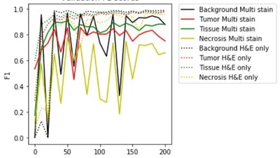 Generalizing multistain immunohistochemistry tissue segmentation using one-shot color deconvolution deep neural networks featured image