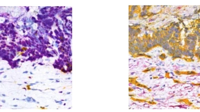 Virtualization of tissue staining in digital pathology using an unsupervised deep learning approach featured image