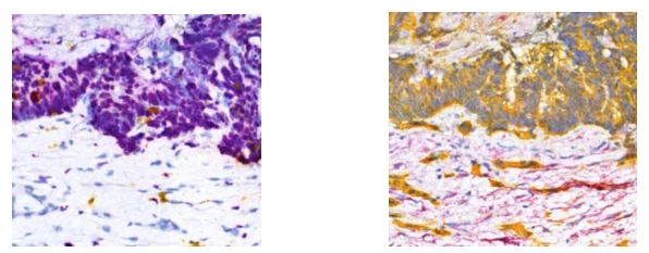 Virtualization of tissue staining in digital pathology using an unsupervised deep learning approach