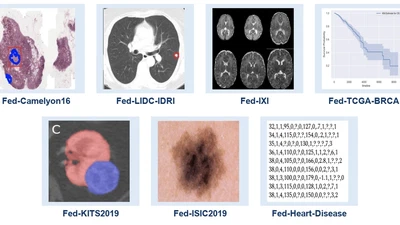 Flamby: Datasets and benchmarks for cross-silo federated learning in realistic healthcare settings featured image