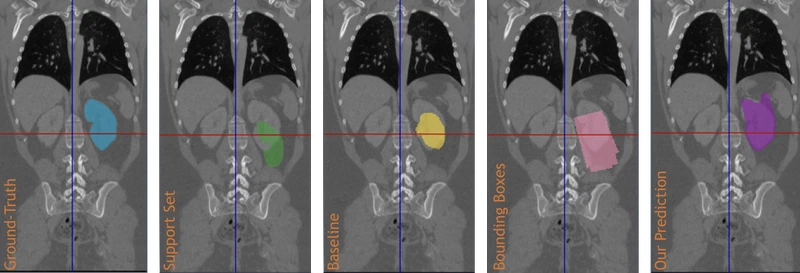 Learn to Segment Organs with a Few Bounding Boxes