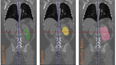 Learn to Segment Organs with a Few Bounding Boxes featured image