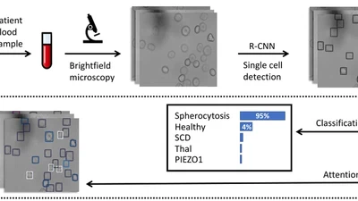 Attention Based Multiple Instance Learning for Classification of Blood Cell Disorders featured image