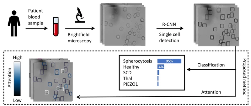 Attention Based Multiple Instance Learning for Classification of Blood Cell Disorders