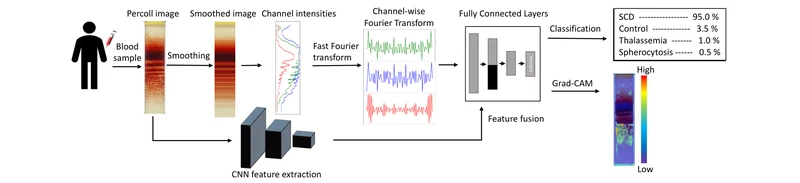 Fourier Transform of Percoll Gradients Boosts CNN Classification of Hereditary Hemolytic Anemias