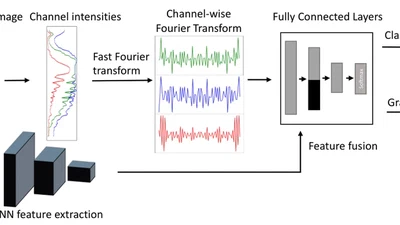 Fourier Transform of Percoll Gradients Boosts CNN Classification of Hereditary Hemolytic Anemias featured image