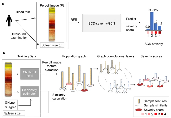 Sickle Cell Disease Severity Prediction from Percoll Gradient Images using Graph Convolutional Networks