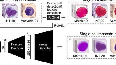 Unsupervised Cross-Domain Feature Extraction for Single Blood Cell Image Classification featured image