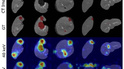 Benefit of dual energy CT for lesion localization and classification with convolutional neural networks featured image