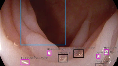 A learning without forgetting approach to incorporate artifact knowledge in polyp localization tasks featured image