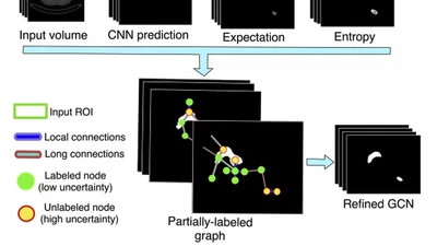 An Uncertainty-Driven GCN Refinement Strategy for Organ Segmentation featured image